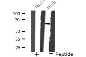 Western blot analysis of extracts from HuvEc cells, using SH2B2 antibody. (SH2B2 anticorps  (N-Term))