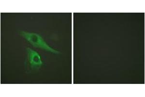 Immunofluorescence analysis of HeLa cells, using Keratin 8 (Ab-73) Antibody. (KRT8 anticorps  (AA 41-90))