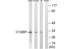Western blot analysis of extracts from Jurkat cells, K562 cells and HUVEC cells, using C1QBP antibody. (C1QBP anticorps  (Internal Region))