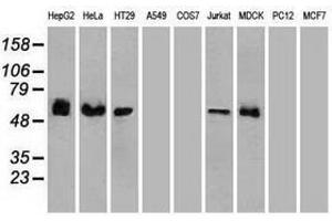 Image no. 6 for anti-Checkpoint Kinase 2 (CHEK2) antibody (ABIN1497499) (CHEK2 anticorps)