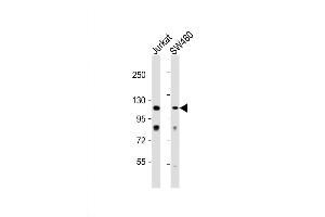Western Blot at 1:1000 dilution Lane 1: Jurkat whole cell lysate Lane 2: SW480 whole cell lysate Lysates/proteins at 20 ug per lane. (MAP3K9 anticorps  (C-Term))