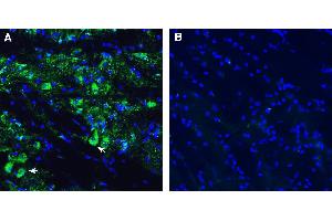 Expression of SLC10A4 in mouse nucleus basalis magnocellularis (NBM).
