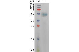 Human IL12B Protein, His Tag on SDS-PAGE under reducing condition.