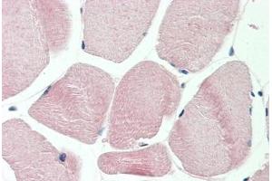Human Skeletal Muscle: Formalin-Fixed, Paraffin-Embedded (FFPE) (GAPDH anticorps  (AA 107-156))