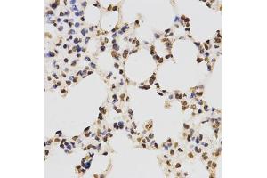 Immunohistochemistry of paraffin-embedded mouse lung using Asymmetric DiMethyl-Histone H3-R17 antibody (ABIN1872982) at dilution of 1:200 (40x lens). (Histone 3 anticorps  (H3R17me2a))