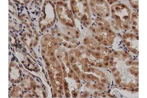 Image no. 3 for anti-DnaJ (Hsp40) Homolog, Subfamily A, Member 2 (DNAJA2) antibody (ABIN1497858)