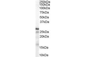 ABIN184587 (1µg/ml) staining of Human Breast lysate (35µg protein in RIPA buffer). (CDKN1B anticorps  (C-Term))