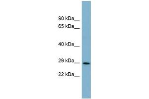 WB Suggested Anti-DCUN1D1  Antibody Titration: 0. (DCUN1D1 anticorps  (Middle Region))
