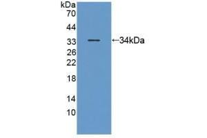 Detection of Recombinant ANTXR2, Human using Polyclonal Antibody to Anthrax Toxin Receptor 2 (ANTXR2)
