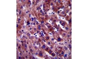Immunohistochemistry analysis in formalin fixed and paraffin embedded human liver tissue reacted with PON1 Antibody (Center) followed which was peroxidase conjugated to the secondary antibody and followed by DAB staining.