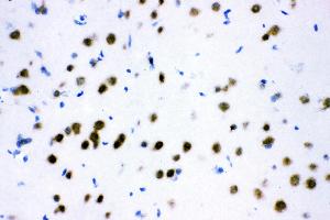 IHC analysis of ATF2 using anti-ATF2 antibody .