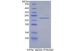 SDS-PAGE (SDS) image for Acetylcholinesterase (AChE) (AA 377-574) protein (His tag) (ABIN1098813) (Acetylcholinesterase Protein (AChE) (AA 377-574) (His tag))