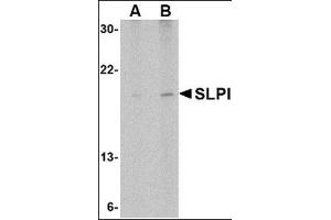 Western blot analysis of SLPI in Daudi cell lysate with this product at (A) 1 and (B) 2 μg/ml. (SLPI anticorps  (Center))