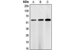 Western blot analysis of CHK1 expression in HEK293T (A), NIH3T3 (B), rat heart (C) whole cell lysates. (CHEK1 anticorps  (Center))