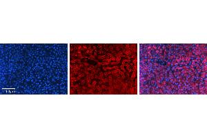 Rabbit Anti-GAPDH Antibody   Formalin Fixed Paraffin Embedded Tissue: Human Liver Tissue Observed Staining: Cytoplasm in hepatocytes Primary Antibody Concentration: 1:100 Other Working Concentrations: N/A Secondary Antibody: Donkey anti-Rabbit-Cy3 Secondary Antibody Concentration: 1:200 Magnification: 20X Exposure Time: 0.