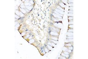 Immunohistochemistry of paraffin-embedded human colon using CPA1 antibody. (CPA1 anticorps)