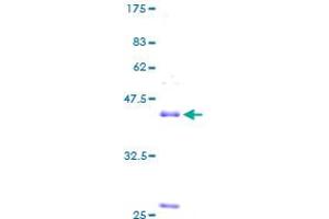 Image no. 1 for Natriuretic Peptides B (NPPB) (AA 1-134) protein (GST tag) (ABIN1312892)