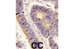 Immunohistochemistry (IHC) image for anti-Golgi-Associated PDZ and Coiled-Coil Motif Containing (GOPC) antibody (ABIN3003090)