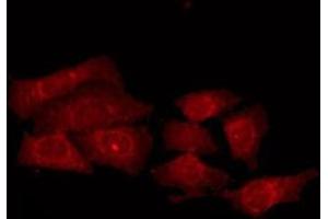 ABIN6275538 staining HepG2 by IF/ICC. (PRKY anticorps)