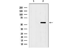 anti-Src Kinase Associated Phosphoprotein 2 (SKAP2) (C-Term) antibody