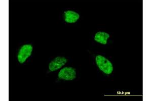 Immunofluorescence of purified MaxPab antibody to A1CF on HeLa cell. (A1CF anticorps  (AA 1-594))