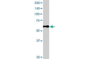 CALD1 MaxPab rabbit polyclonal antibody. (Caldesmon anticorps  (AA 1-538))
