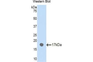 Western blot analysis of the recombinant protein. (PLXNB1 anticorps  (AA 47-173))