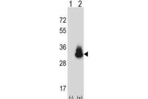 Western Blotting (WB) image for anti-Carcinoembryonic Antigen-Related Cell Adhesion Molecule 3 (CEACAM3) antibody (ABIN2997578) (CEACAM3 anticorps)