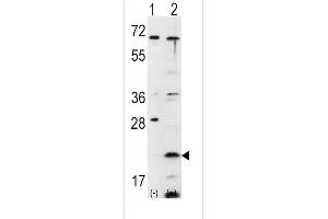 Western blot analysis of FXN using rabbit polyclonal FXN Antibody using 293 cell lysates (2 ug/lane) either nontransfected (Lane 1) or transiently transfected with the FXN gene (Lane 2). (Frataxin anticorps  (C-Term))