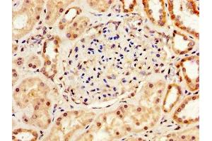 IHC image of ABIN7166424 diluted at 1:200 and staining in paraffin-embedded human kidney tissue performed on a Leica BondTM system.