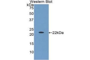 Western Blotting (WB) image for anti-Insulin-Like Growth Factor Binding Protein 1 (IGFBPI) (AA 112-263) antibody (ABIN1859301) (IGFBPI anticorps  (AA 112-263))