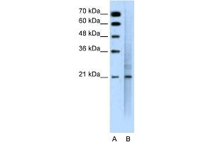 WB Suggested Anti-MUC1 Antibody Titration: 0.