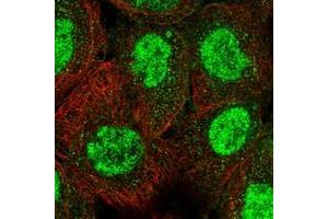 Immunofluorescent staining of human cell line A-431 with TRIM66 polyclonal antibody  at 1-4 ug/mL dilution shows positivity in nucleus but not nucleoli. (TRIM66 anticorps)