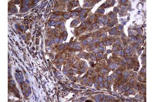 Image no. 19 for anti-Tumor Necrosis Factor Receptor Superfamily, Member 8 (TNFRSF8) (AA 19-379) antibody (ABIN1491084)