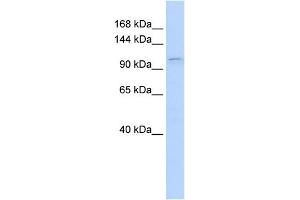 WB Suggested Anti-PGR Antibody Titration:  0. (Progesterone Receptor anticorps  (N-Term))
