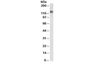 Western blot testing of ThP1 cell lysate with CD31 antibody (clone JC/70A). (CD31 anticorps)