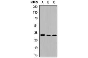 Western blot analysis of Adenosine A2b Receptor expression in SHSY5Y (A), NIH3T3 (B), rat kidney (C) whole cell lysates. (Adenosine A2b Receptor anticorps  (C-Term))