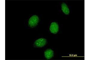 Immunofluorescence of purified MaxPab antibody to SSBP2 on HeLa cell. (SSBP2 anticorps  (AA 1-361))