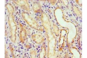 Immunohistochemistry of paraffin-embedded human kidney tissue using ABIN7150217 at dilution of 1:100 (ALKBH2 anticorps  (AA 1-261))