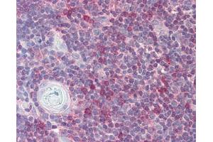 Image no. 1 for anti-RAN, Member RAS Oncogene Family (RAN) (AA 1-179) antibody (ABIN467626)