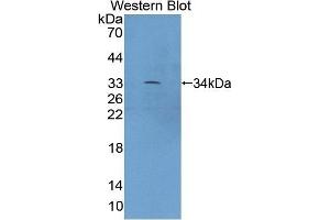 Detection of Recombinant XYLT2, Mouse using Polyclonal Antibody to Xylosyltransferase II (XYLT2)