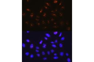 Immunofluorescence analysis of U-2 OS cells using Fibrillarin/U3 RNP Rabbit mAb (ABIN7267175) at dilution of 1:100 (40x lens). (Fibrillarin anticorps)