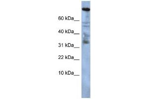 Western Blotting (WB) image for anti-Zinc Finger Protein 251 (ZNF251) antibody (ABIN2458235) (ZNF251 anticorps)