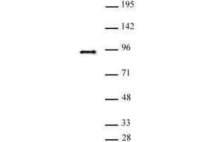 SATB2 antibody (pAb) tested by Western blot. (SATB2 anticorps  (C-Term))