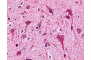 Anti-GPR75 antibody IHC of human brain, neurons and glia. (GPR75 anticorps  (C-Term))