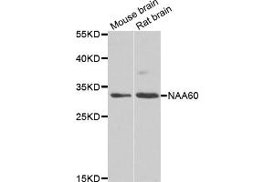 Western blot analysis of extracts of various cell lines, using NAA60 antibody (ABIN5975517) at 1/1000 dilution. (NAT15 anticorps)