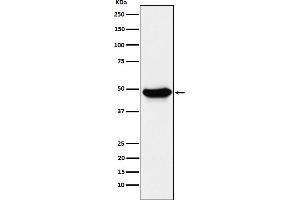 Western blot analysis of ENTPD5 expression in LnCaP cell lysate.