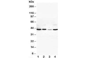 Western blot testing of VEGFD antibody and Lane 1:  SW620;  2: COLO320;  3: 6T-CEM;  4: HT1080 cell lysate (VEGFD anticorps  (Middle Region))