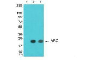 Western blot analysis of extracts from HeLa cells and A549 cells using ARC antibody. (ARC anticorps)