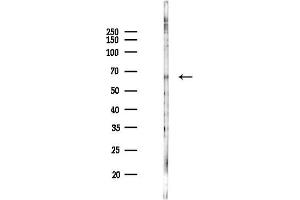 Western blot analysis of lysates from PC12 cells(LPS 4h treatment), using Phospho-ZAP70 (Tyr493) Antibody at 1/1000 dilution.